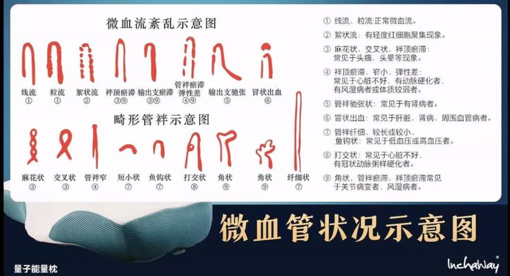 sachaway energy pillow